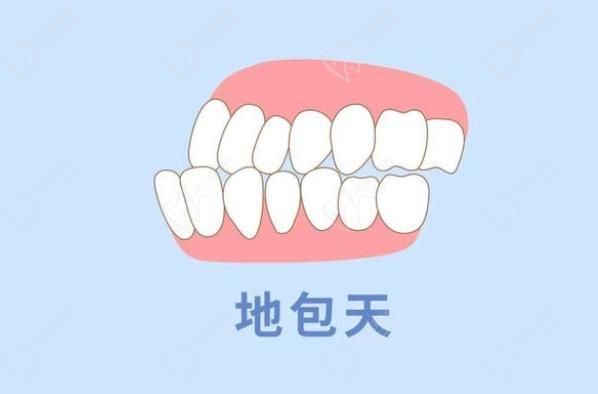 乳牙地包天换牙后会正常吗？