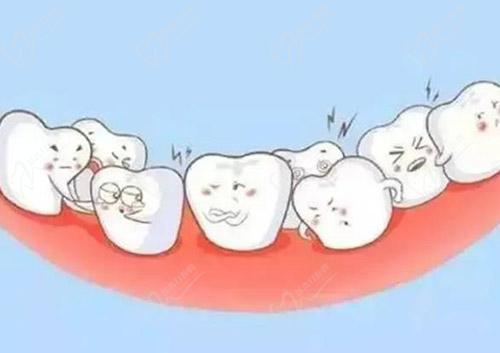 正畸牙齿有咔嚓声音正常吗