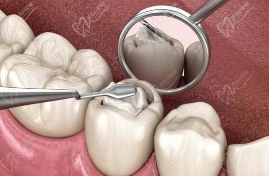 补牙后牙齿疼痛正常吗？