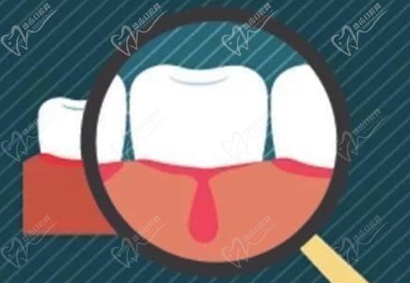 牙龈反复红肿是怎么回事？