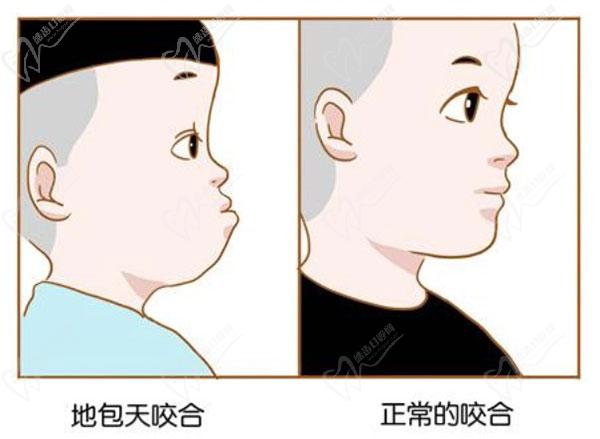 地包天