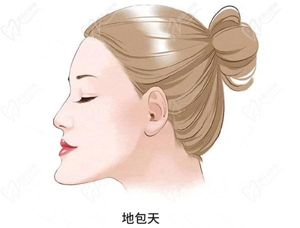 17岁地包天还能矫正吗