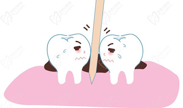塞牙缝怎么治疗处理