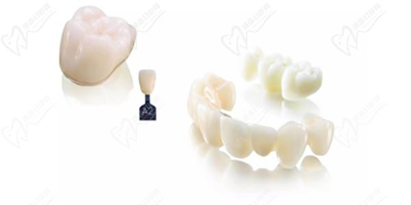 cadcam氧化锆全瓷牙优势