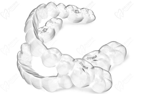 时代天使隐形矫正 时代天使隐形矫正