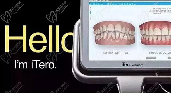 牙齿矫正黑科技iTero口扫