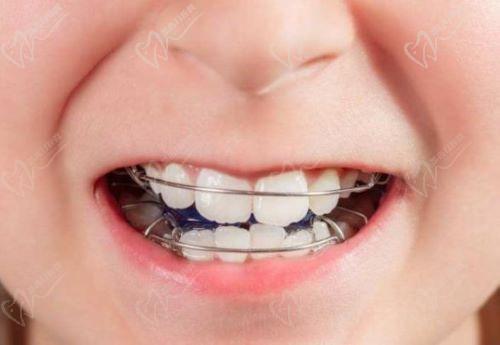 儿童牙齿矫正的黄金时期是几岁