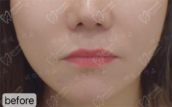胡俊杰个人资料简介