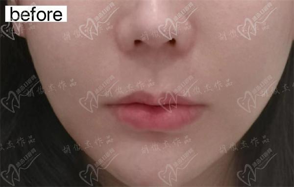 胡俊杰个人资料简介