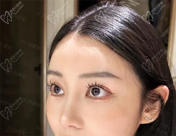 刘彦军鼻修复价格