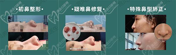 宫风勇做鼻子好吗