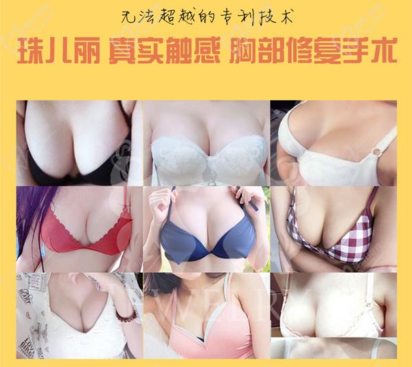 韩国珠儿丽整形隆胸图片