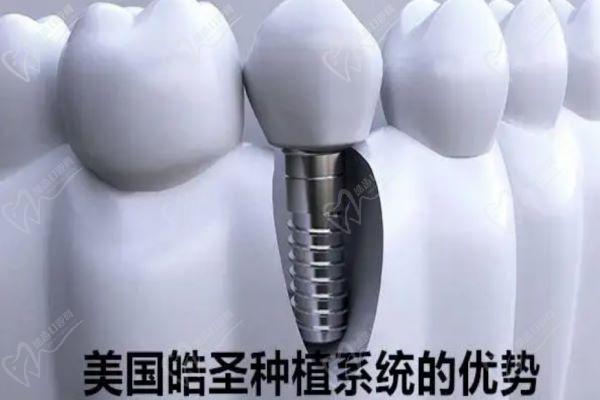 广州广大口腔医院种植牙
