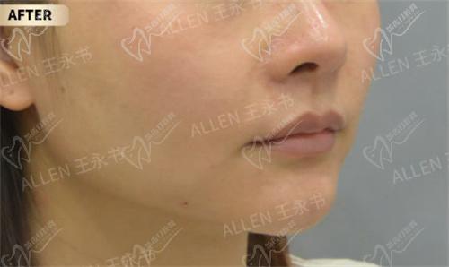 王永书注射医生怎么样 王永书注射医生怎么样