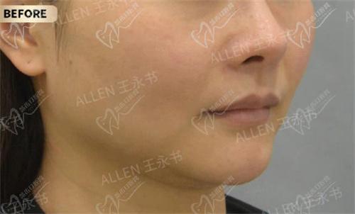 王永书注射医生怎么样 王永书注射医生怎么样