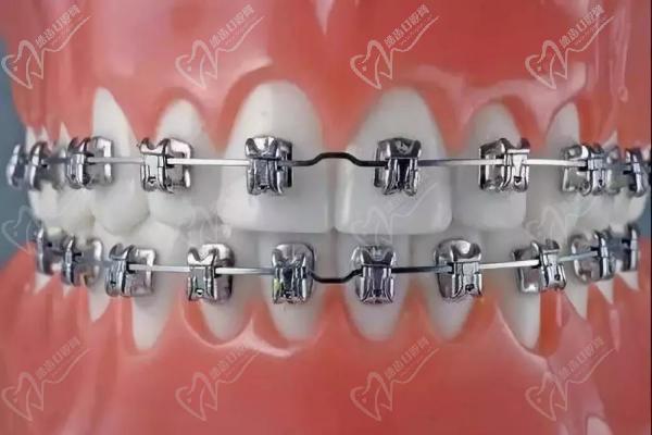 上海雅悦齿科牙齿矫正
