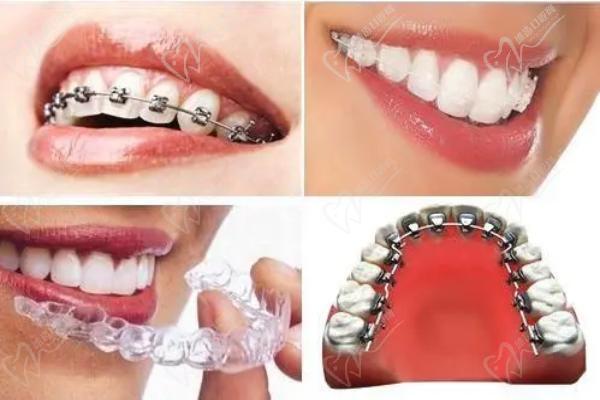 上海雅悦齿科矫正