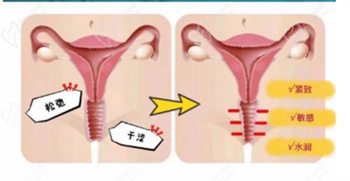 成都九龙医院孙梅医生可以做3d生物束带吗