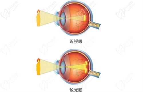 济南麦迪格近视手术怎么样