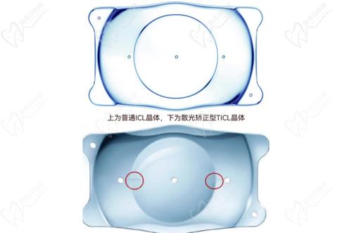 济南麦迪格近视手术怎么样