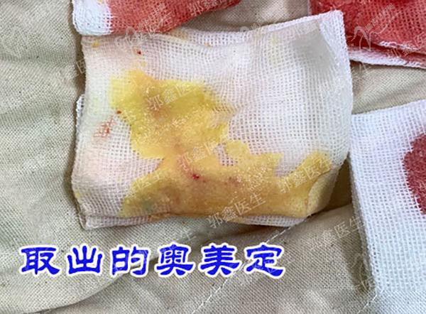 北京郭鑫取生长因子怎样？