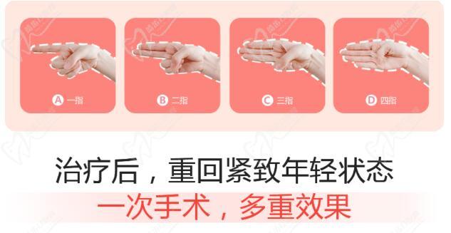 3d生物束带紧缩术能到几指