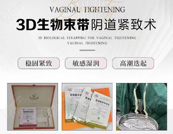 3d束带紧缩术<span style=