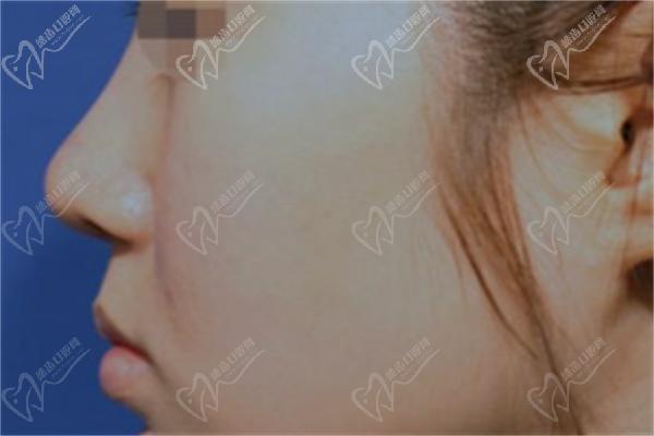 黄在弘做鼻子怎么样 黄在弘做鼻子怎么样