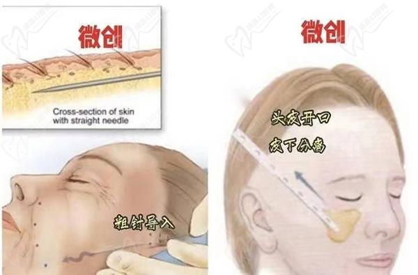 哈尔滨名大整形医院除皱价格表