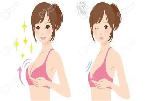 窦玺隆胸手术怎么样
