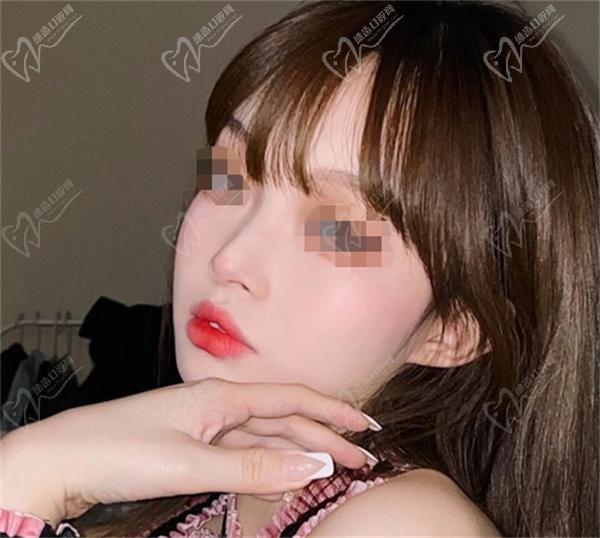 付俊俐医生做鼻子怎么样