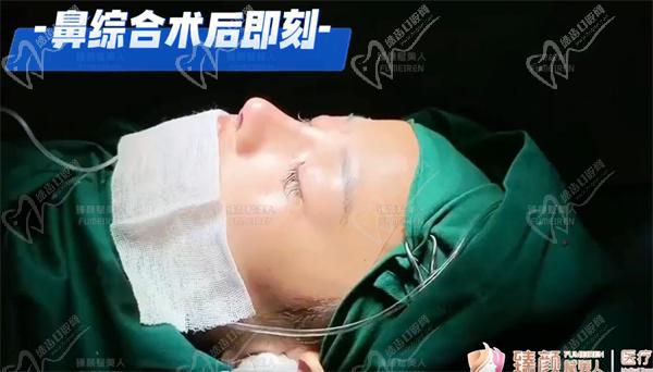 郑州臻颜池凯隆鼻手术图片
