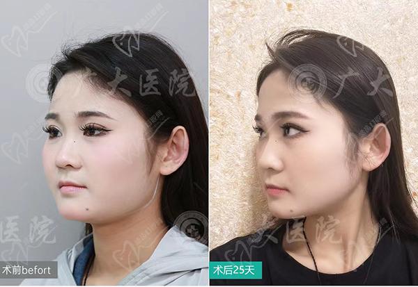 广大医院颌面外科是三 甲医院吗