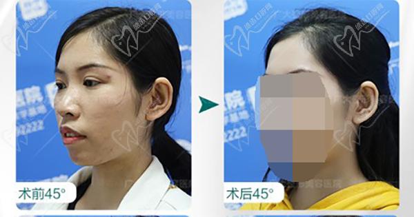 何锦泉正颌优势