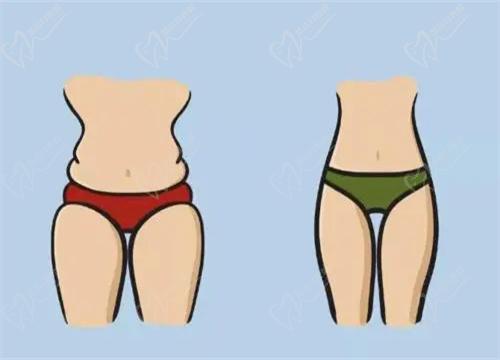 宋延刚吸脂技术怎么样