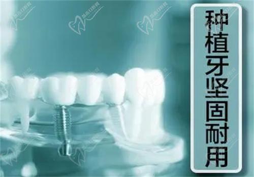 天津诺尔口腔韩系种植牙怎么样