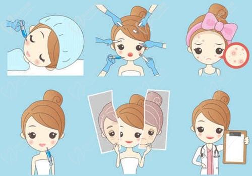 西安李高峰和张兆祥哪个厉 害