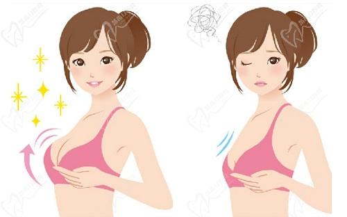 西安李高峰医生擅长隆胸