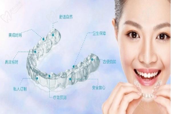 隐形牙套示意图