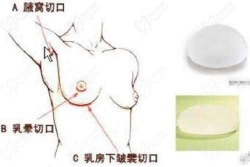 穆大力医生擅长项目