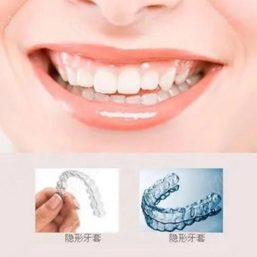 杭州雅莱齿科王龙医生矫正牙齿的口碑 杭州雅莱齿科王龙医生矫正牙齿的口碑