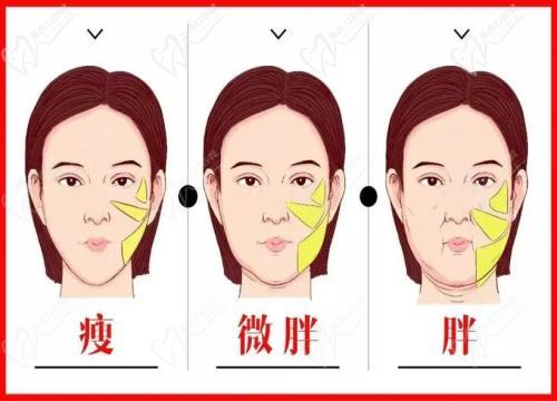 周敏茹坐诊哪家医院