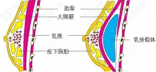 杭州栗勇为什么这么贵