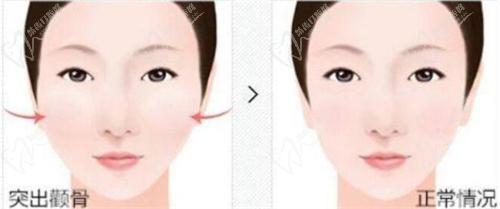 刘先超医生在哪个医院坐诊？