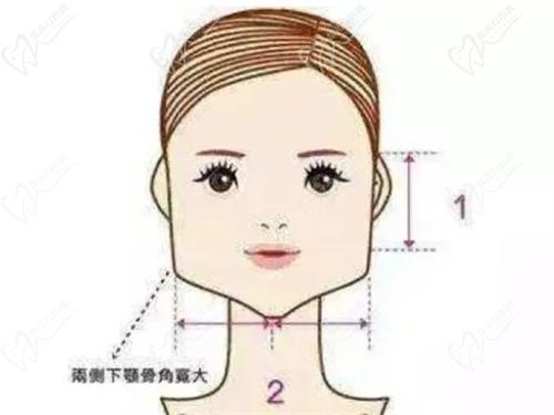 武汉磨骨医生哪个好？