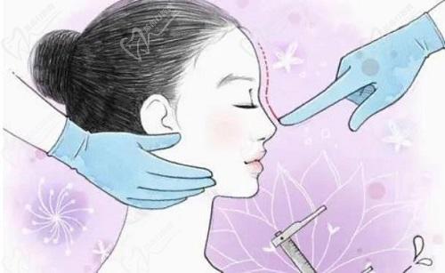苏州美莱张亮做鼻子口碑评价