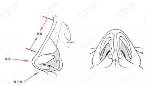 长沙吴蒙做鼻子风格 长沙吴蒙做鼻子风格