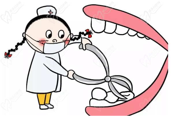 上海雅悦齿科詹进汉医生拔牙技术好