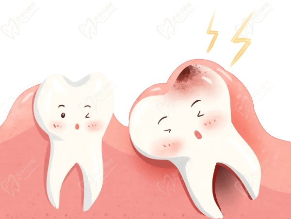 上海雅悦齿科下颌正位智齿拔除需要注意什么？