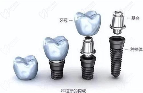 邯郸连保强口腔补牙及其他项目价格表：